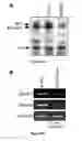 Fig. 04 - Methods and compositions for inducing deregulation of EPHA7 and ERK phosphorylation in human acute leukemias