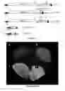 Fig. 23 - System For Expression Of Genes In Plants From A Virus-Based Expression Vector