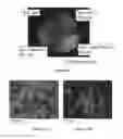 Fig. 32 - System For Expression Of Genes In Plants From A Virus-Based Expression Vector