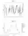 Fig. 08 - Analysis of a polynucleotide via a nanopore system