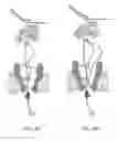 Fig. 34 - Compositions, systems, and methods for detecting events using tethers anchored to or adjacent to nanopores