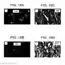 Fig. 26 - Compositions and methods for treating or preventing prostate cancer and for detecting androgen receptor variants