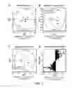 Fig. 04 - Compositions and methods for detecting neoplasia