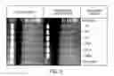 Fig. 04 - Personalized tumor biomarkers
