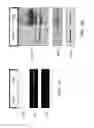 Fig. 06 - Compositions comprising soluble CD84 or anti-CD84 antibodies and methods for diagnosing and treating B-CLL