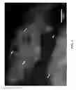 Fig. 02 - COMPOSITIONS AND METHODS FOR DETECTING, EXTRACTING, VISUALIZING, AND IDENTIFYING PROTOMYXZOA RHUEMATIC