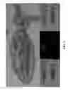 Fig. 04 - COMPOSITIONS AND METHODS FOR DETECTING, EXTRACTING, VISUALIZING, AND IDENTIFYING PROTOMYXZOA RHUEMATIC