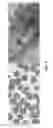 Fig. 06 - COMPOSITIONS AND METHODS FOR DETECTING, EXTRACTING, VISUALIZING, AND IDENTIFYING PROTOMYXZOA RHUEMATIC