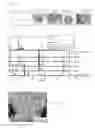 Fig. 04 - Method for recovering rare earth element
