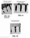 Fig. 07 - Method for electrochemically depositing metal on a reactive metal film