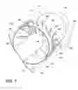 Fig. 08 - Shroud assembly for turbine engine