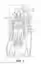 Fig. 02 - Dual fuel engine having selective compression reduction