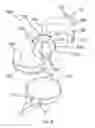 Fig. 09 - Method and apparatus for releasably immobilizing an attachment to an external object