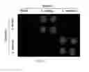 Fig. 07 - Methods and compositions for hybrid microfluidic devices integrated with nano-biosensors