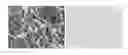 Fig. 01 - Method of identifying treatment responsive non-small cell lung cancer using anaplastic lymphoma kinase (ALK) as a marker