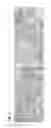 Fig. 07 - Method of identifying treatment responsive non-small cell lung cancer using anaplastic lymphoma kinase (ALK) as a marker