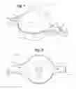 Fig. 02 - Fish finder device housing and system