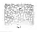 Fig. 07 - METHODS FOR DRIVING ELECTROPHORETIC DISPLAYS USING DIELECTROPHORETIC FORCES
