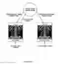 Fig. 13 - Remote cloud based medical image sharing and rendering semi-automated or fully automated network and/or web-based, 3D and/or 4D imaging of anatomy for training, rehearsing and/or conducting medical procedures, using multiple standard X-ray and/or other imaging projections, without a need for special hardware and/or systems and/or pre-processing/analysis of a captured image data