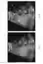Fig. 07 - Systems and methods for selective enhancement of a region of interest in an image