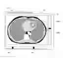 Fig. 01 - X-ray CT apparatus and image reconstruction method