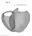 Fig. 06 - Apparatus and method for visualization of myocardial infarct areas and accessory pathways