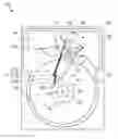 Fig. 01 - Reducing ion migration in a hard disk drive microactuator flexure assembly