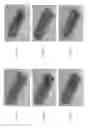 Fig. 16 - Method for optimizing fluid flow across a sample within an electron microscope sample holder
