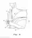 Fig. 09 - Zeroing adjustment for depth control system