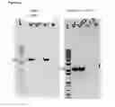 Fig. 05 - Method for removing genetic linkage in a plant