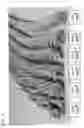 Fig. 09 - ROTARY DIE ASSEMBLIES, METHODS FOR USING SAME, AND FOOD PRODUCTS MADE BY SAME
