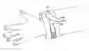 Fig. 01 - Cuff for clothing article