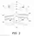 Fig. 03 - Hand Restraint Gloves