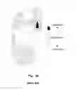 Fig. 05 - In-Shoe Support Device For Heeled Shoes