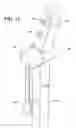 Fig. 14 - CANTILEVERED UMBRELLA
