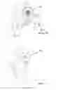 Fig. 12 - Hair Accessory and Method of Styling Hair