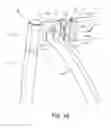 Fig. 11 - CHAIR WITH FLEX MEMBER