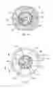 Fig. 11 - Method for identifying objects in a subject's ear