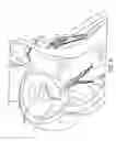 Fig. 07 - DIRECT VIEW OPTICAL CARDIAC CATHETER