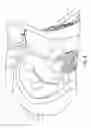 Fig. 08 - DIRECT VIEW OPTICAL CARDIAC CATHETER