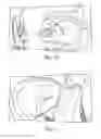 Fig. 09 - DIRECT VIEW OPTICAL CARDIAC CATHETER