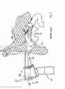 Fig. 03 - Otoscope