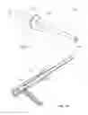 Fig. 02 - Sealing device for colonoscopy procedure
