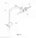 Fig. 03 - Sealing device for colonoscopy procedure