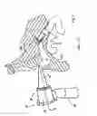 Fig. 03 - Otoscope