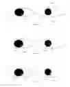 Fig. 05 - Systems and methods for improved ophthalmic imaging