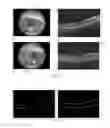 Fig. 06 - Systems and methods for improved ophthalmic imaging