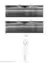 Fig. 07 - Systems and methods for improved ophthalmic imaging
