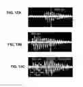 Fig. 11 - Device and method for in vivo noninvasive magnetic manipulation of circulating objects in bioflows