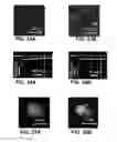 Fig. 17 - Device and method for in vivo noninvasive magnetic manipulation of circulating objects in bioflows